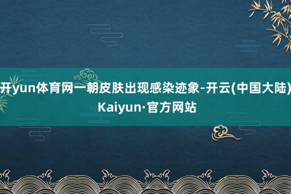 开yun体育网一朝皮肤出现感染迹象-开云(中国大陆) Kaiyun·官方网站